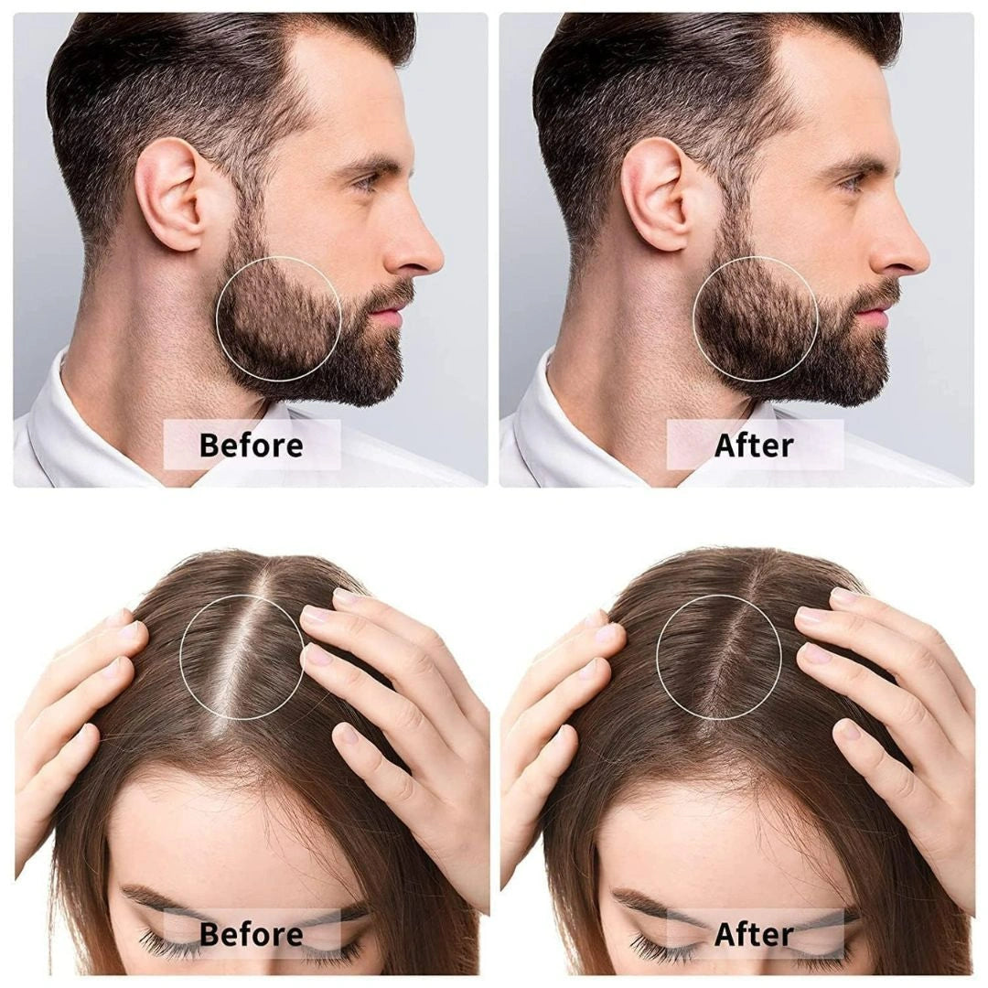 Derma Roller For Hair & Beard Growth 0.5 mm