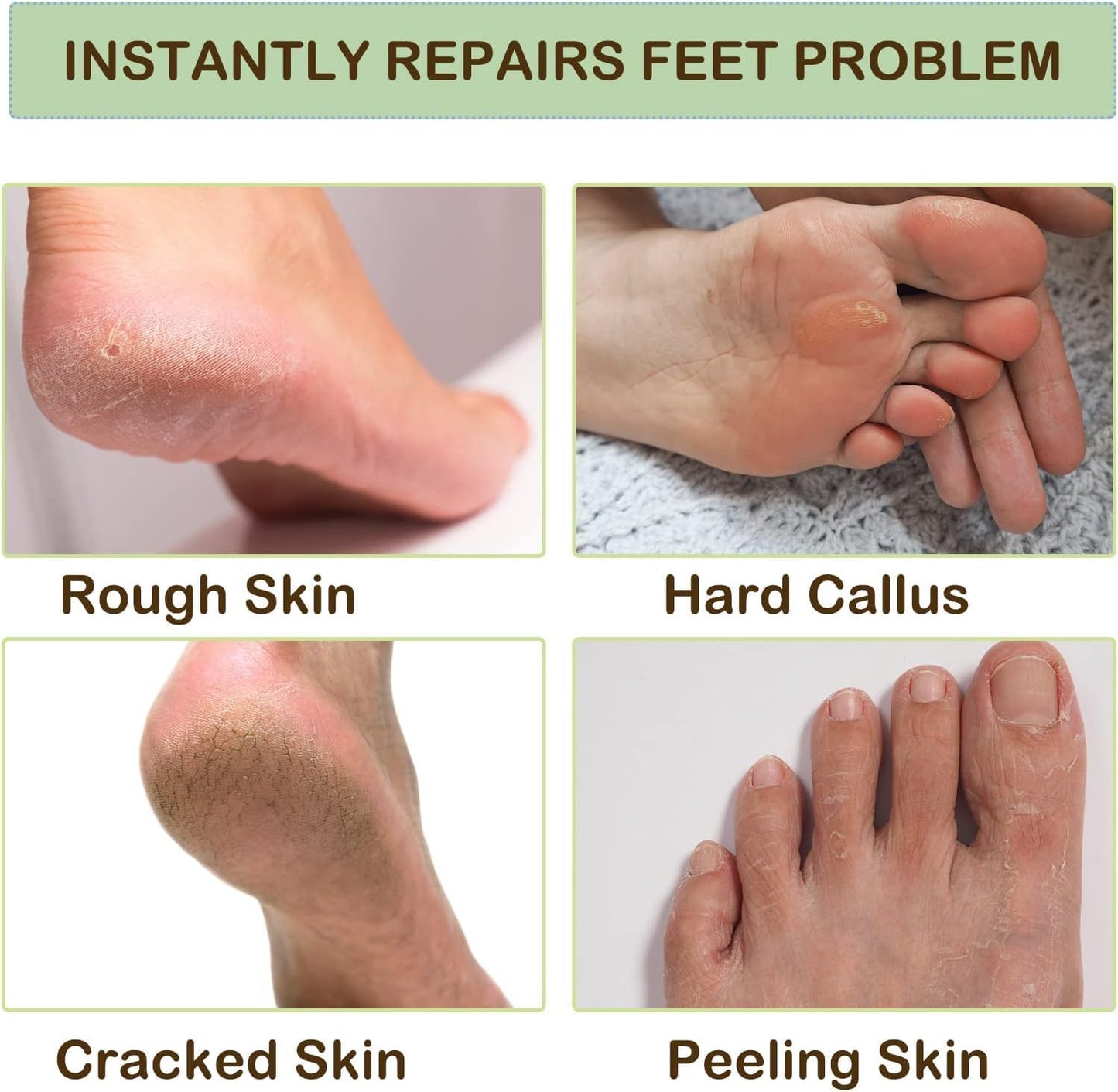 Siicon Moisturizing Gel Socks